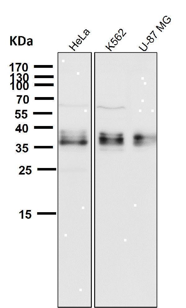 m03161 wb8