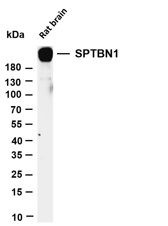Various whole cell lysates were separated by 4-20% SDS-PAGE, and the membrane was blotted with anti-SPTBN1 antibody