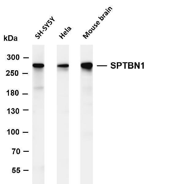 m03164 1 sptbn1 primary antibodies wb testing 4