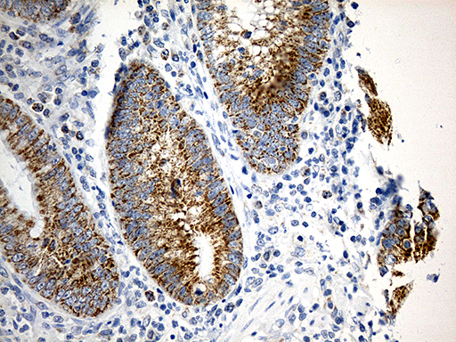 m03166 1 anti tomm40 mouse monoclonal antibody clone id oti9a3 ihc testing 2