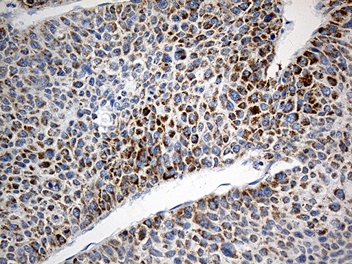 m03166 1 anti tomm40 mouse monoclonal antibody clone id oti9a3 ihc testing 3