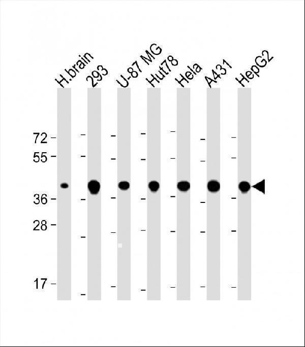 m03166 anti tomm40 antibody n term wb testing 2