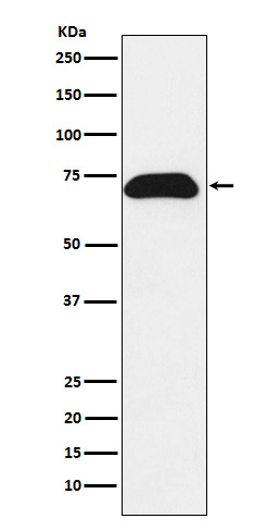 Western blot analysis of PDZK1 expression in T47-D cell lysate.