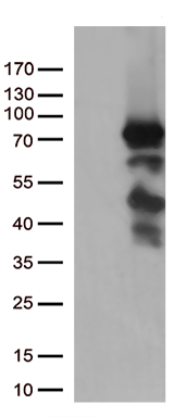 HEK293T cells were transfected with the pCMV6-ENTRY control (Left lane) or pCMV6-ENTRY PDZK1 (Right lane) cDNA for 48 hrs and lysed