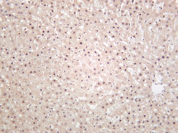 Rat liver was stained with anti-Fibrillarin rabbit antibody