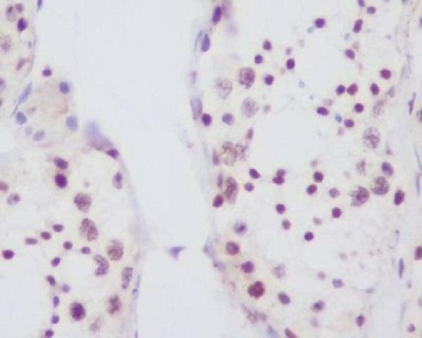 Immunohistochemical analysis of paraffin-embedded human testis, using Fibrillarin Antibody