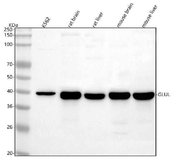  Western blot analysis of GLUL using anti-GLUL antibody (M03191-1)