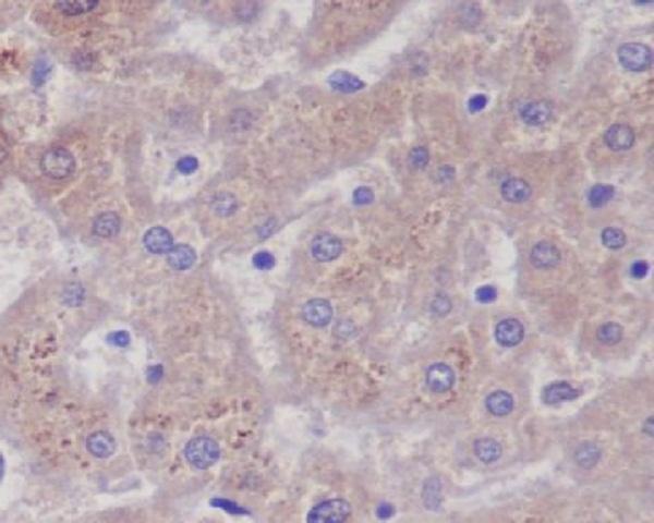 m03191 ihc