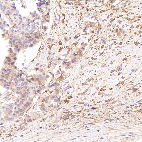 m03191 ihc10