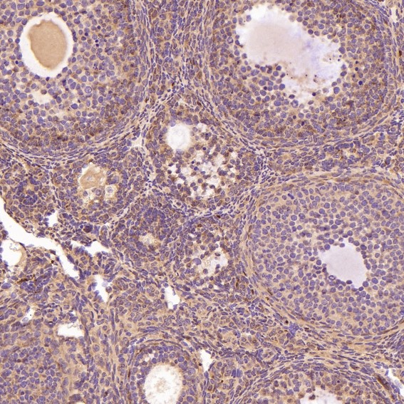 m03191 ihc11