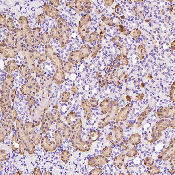 m03191 ihc7
