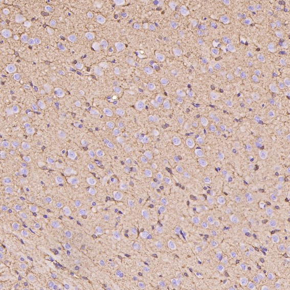 m03191 ihc8