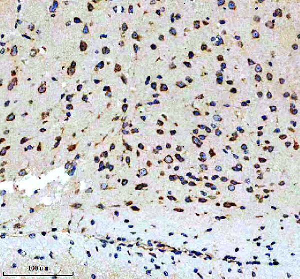 IHC analysis of CALU using anti-CALU antibody (M03193-1)