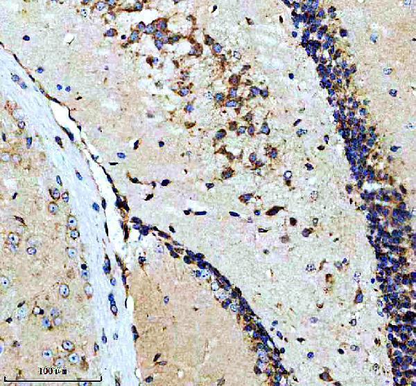 IHC analysis of CALU using anti-CALU antibody (M03193-1)