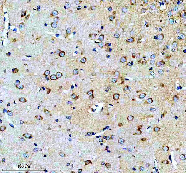 m03193 1 calu primary antibodies ihc testing 3