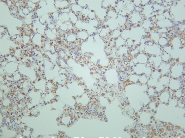 Mouse lung was stained with anti-Rictor rabbit antibody