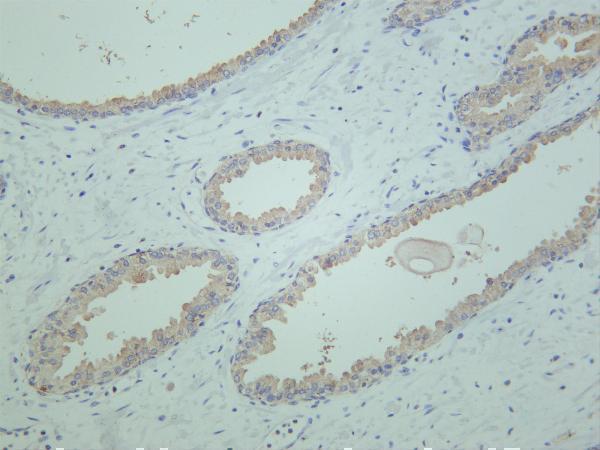 Human prostate was stained with anti-Rictor rabbit antibody