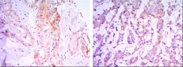 m03195 rictor primary antibodies ihc testing 3
