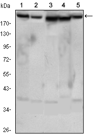 m03195 rictor primary antibodies wb testing 2