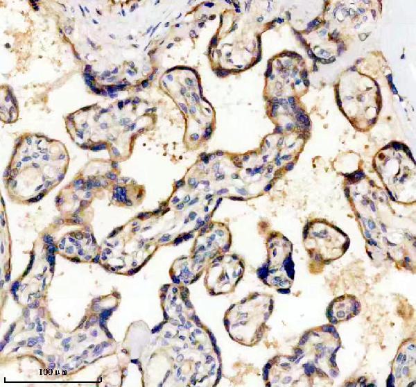 IHC analysis of CD39/ENTPD1 using anti-CD39/ENTPD1 antibody (M03196-2)
