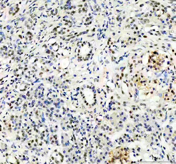 IHC analysis of CHD3 using anti-CHD3 antibody (M03200)