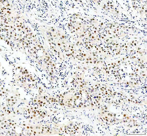 IHC analysis of CHD3 using anti-CHD3 antibody (M03200)