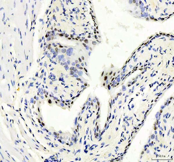 m03200 chd3 primary antibodies ihc testing 3