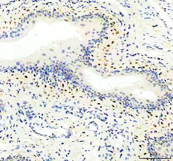 m03200 chd3 primary antibodies ihc testing 4
