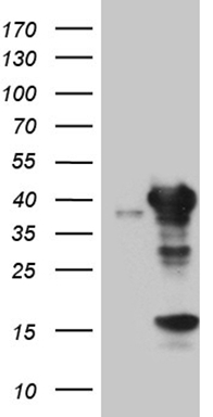HEK293T cells were transfected with the pCMV6-ENTRY control (Left lane) or pCMV6-ENTRY UROD (Right lane) cDNA for 48 hrs and lysed