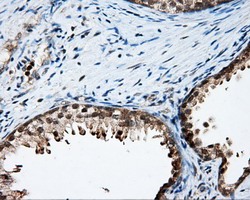 m03211 anti lipg mouse monoclonal antibody clone id oti4a8 ihc testing 5