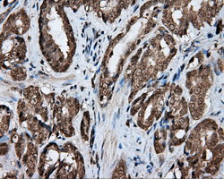 m03211 anti lipg mouse monoclonal antibody clone id oti4a8 ihc testing 6