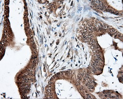 m03211 anti lipg mouse monoclonal antibody clone id oti4a8 ihc testing 7