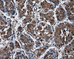 m03211 anti lipg mouse monoclonal antibody clone id oti4a8 ihc testing 9