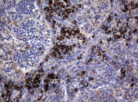 Immunohistochemical staining of paraffin-embedded Human lymph node tissue within the normal limits using anti-MAGEA3 mouse monoclonal antibody