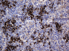 m03212 anti magea3 mouse monoclonal antibody clone id oti1g9 ihc testing 4