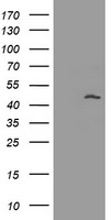 HEK293T cells were transfected with the pCMV6-ENTRY control (Left lane) or pCMV6-ENTRY MAGEA3 (Right lane) cDNA for 48 hrs and lysed