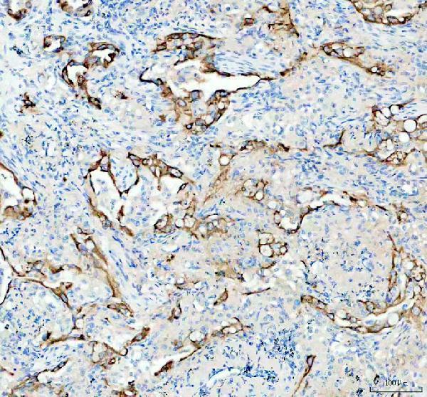IHC analysis of LAMC2/MRC1 using anti-LAMC2/MRC1 antibody (M03214)
