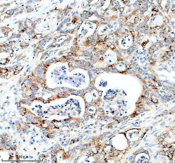 IHC analysis of Laminin gamma 2/LAMC2 using anti-Laminin gamma 2/LAMC2 antibody (M03214)