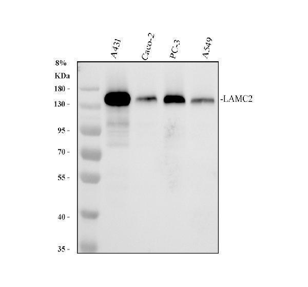 Western blot analysis of LAMC2/MRC1 using anti-LAMC2/MRC1 antibody (M03214)