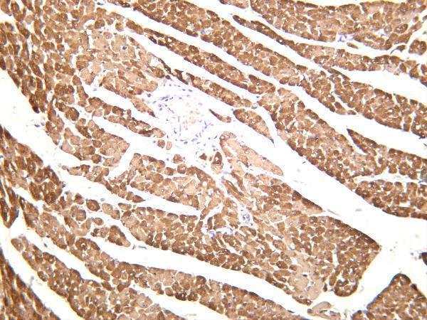 Rat cardiac muscle was stained with anti-MYL2 rabbit antibody