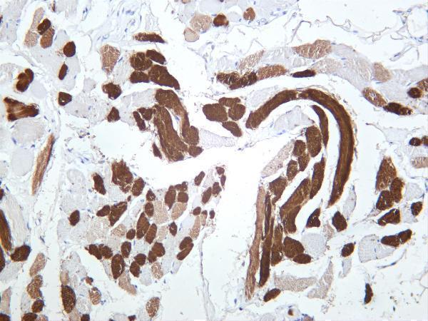 Human skeletal muscle was stained with anti-MYL2 rabbit antibody