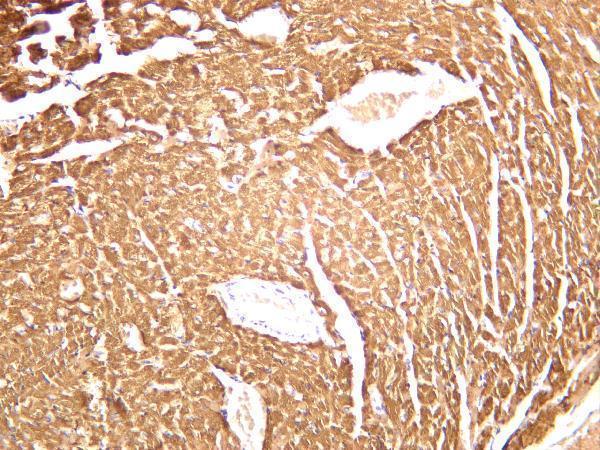 Mouse cardiac muscle was stained with anti-MYL2 rabbit antibody