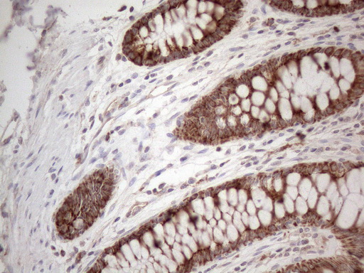 Immunohistochemical staining of paraffin-embedded Human colon tissue within the normal limits using anti-AMT mouse monoclonal antibody