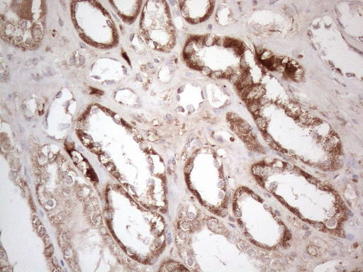 Immunohistochemical staining of paraffin-embedded Human Kidney tissue within the normal limits using anti-AMT mouse monoclonal antibody