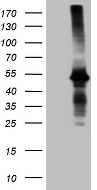 HEK293T cells were transfected with the pCMV6-ENTRY control (Left lane) or pCMV6-ENTRY AMT (Right lane) cDNA for 48 hrs and lysed