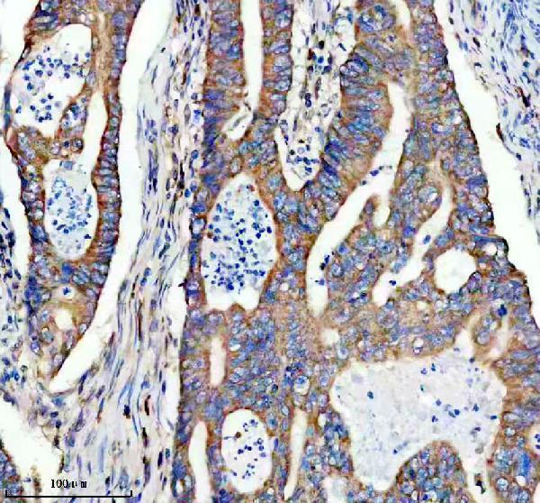 m03218 trpv5 primary antibodies ihc testing 1