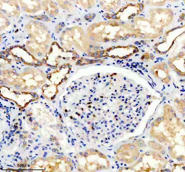 IHC analysis of TRPV5 using anti-TRPV5 antibody (M03218)