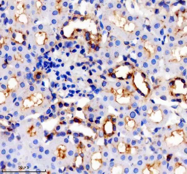 IHC analysis of TRPV5 using anti-TRPV5 antibody (M03218)