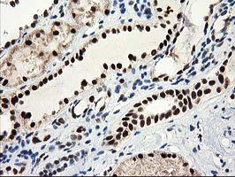 m03221 1 anti nmnat1 mouse monoclonal antibody clone id oti1g4 ihc testing 10