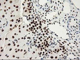 Immunohistochemical staining of paraffin-embedded Human Ovary tissue within the normal limits using anti-NMNAT1 mouse monoclonal antibody